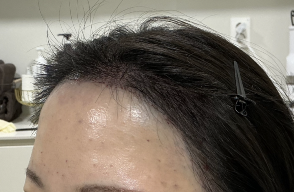 after