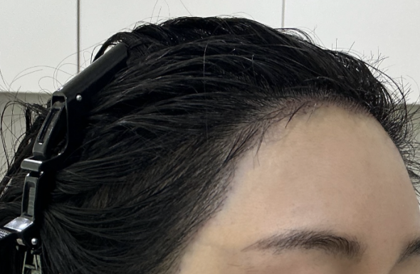 after
